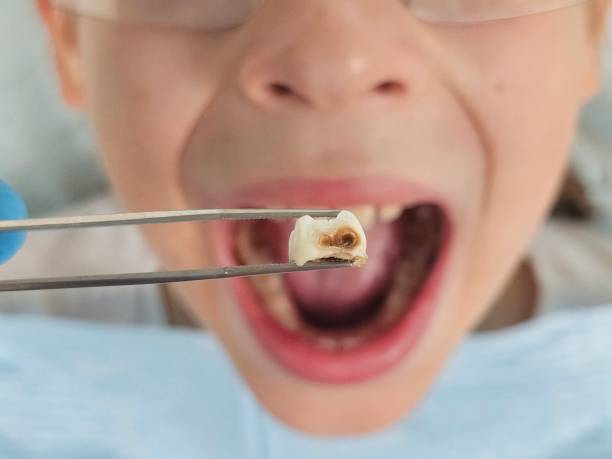Best Emergency Gum Treatment in Woodhaven, MI